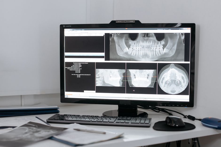 Zahnstein Analyse: Archäologische Einblicke in Ernährung und Gesundheit – Kostenloses Stock Foto zu arbeitsplatz, arzt, ar…